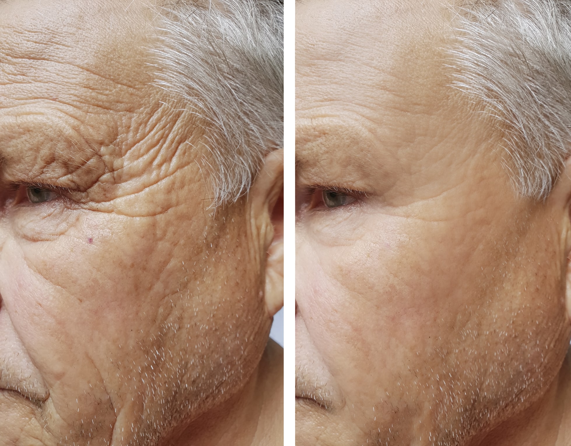 rejuvenation skin care